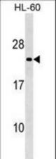 MS4A8B Antibody western blot of HL-60 cell line lysates (35 ug/lane). The MS4A8B antibody detected the MS4A8B protein (arrow).