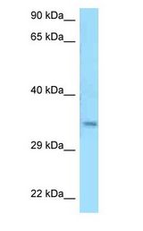 MSANTD3 antibody Western Blot of HepG2.