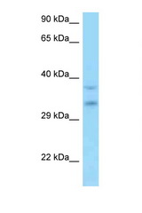 C9orf30 antibody LS-C146308 Western blot of HT1080 Cell lysate. Antibody concentration 1 ug/ml.