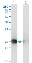 Western blot of MSC expression in transfected 293T cell line by MSC monoclonal antibody (M05), clone 4D7.