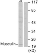 Western blot of extracts from Jurkat cells, using Musculin Antibody. The lane on the right is treated with the synthesized peptide.