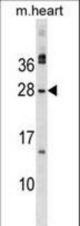 MSC Antibody western blot of mouse heart tissue lysates (35 ug/lane). The MSC antibody detected the MSC protein (arrow).