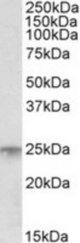 MSC antibody (1 ug/ml) staining of Human Bone Marrow lysate (35 ug protein/ml in RIPA buffer). Primary incubation was 1 hour. Detected by chemiluminescence.