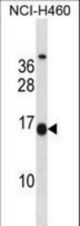 MSGN1 Antibody western blot of NCI-H460 cell line lysates (35 ug/lane). The MSGN1 antibody detected the MSGN1 protein (arrow).