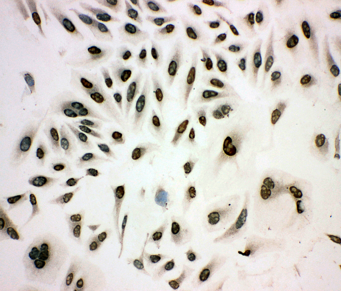 MCM3 antibody. ICC: HELA Cell.