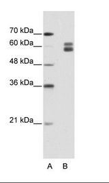 B: HepG2 Cell Lysate