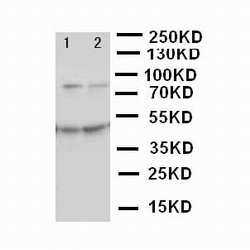 WB of MCM3 antibody. Lane 1: HELA Cell Lysate. Lane 2: JURKAT Cell lysate.