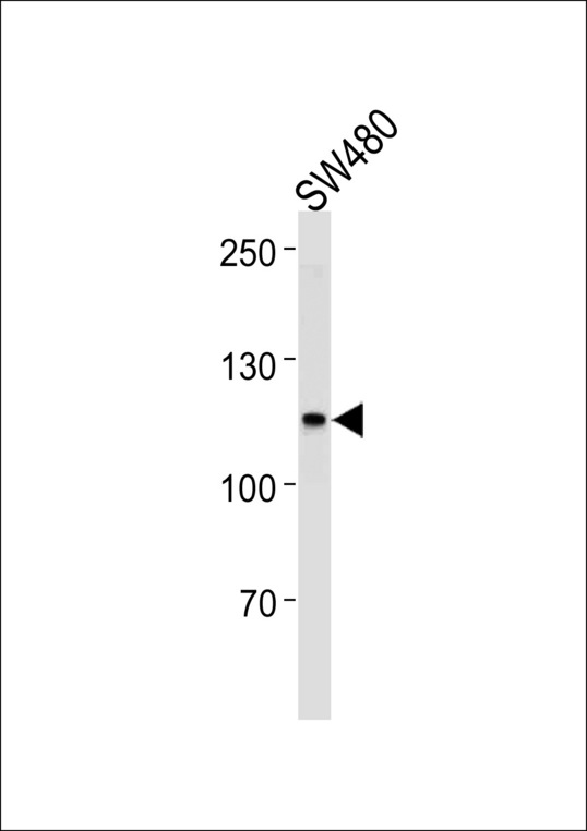 MSH2 Antibody western blot of SW480,U251 cell line lysates (35 ug/lane). The MSH2 antibody detected the MSH2 protein (arrow).