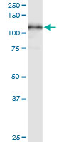MCM3 monoclonal antibody (M06), clone 3E11. Western blot of MCM3 expression in human spleen.