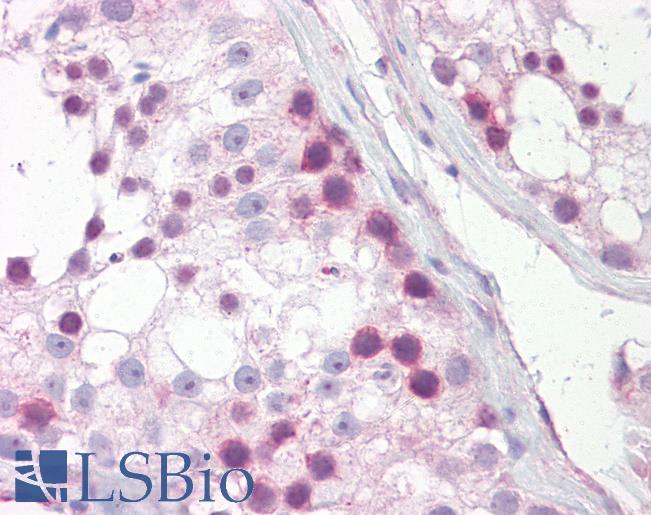 Anti-MSI1 antibody IHC of human testis. Immunohistochemistry of formalin-fixed, paraffin-embedded tissue after heat-induced antigen retrieval. Antibody LS-B7245 concentration 10 ug/ml.