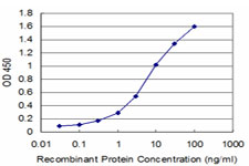 Detection limit for recombinant GST tagged MSI1 is approximately 0.3 ng/ml as a capture antibody.