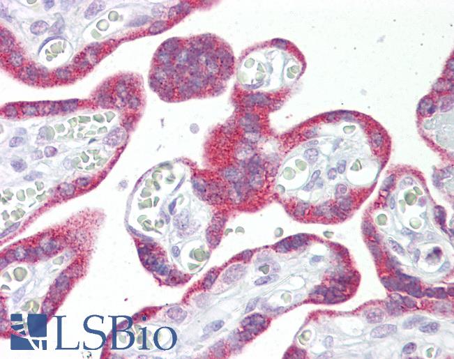 Anti-MSI2 antibody IHC of human placenta. Immunohistochemistry of formalin-fixed, paraffin-embedded tissue after heat-induced antigen retrieval. Antibody LS-B7105 concentration 5 ug/ml.