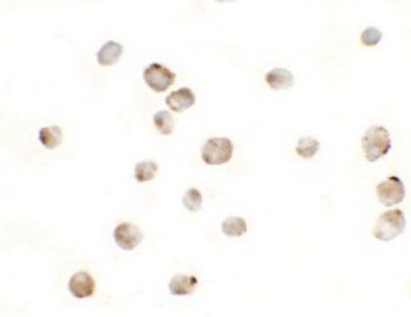 Immunocytochemistry of MSI2 in EL4 cells with MSI2 antibody at 5 ug/ml.