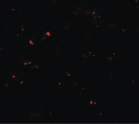 Immunofluorescence of MSI2 in EL4 cells with MSI2 antibody at 20 ug/ml.