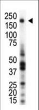 Western blot of anti-RON antibody in THP1 cell lysate. RON (arrow) was detected using purified antibody. Secondary HRP-anti-rabbit was used for signal visualization with chemiluminescence.