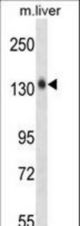 Mouse Mst1r Antibody western blot of mouse liver tissue lysates (35 ug/lane). The Mst1r antibody detected the Mst1r protein (arrow).