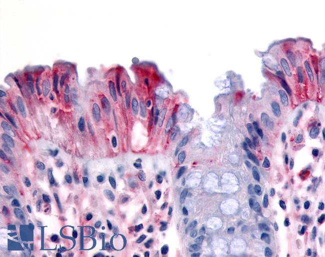 Anti-MST1R / RON antibody LS-A7185 IHC of human colon, surface epithelium. Immunohistochemistry of formalin-fixed, paraffin-embedded tissue after heat-induced antigen retrieval.
