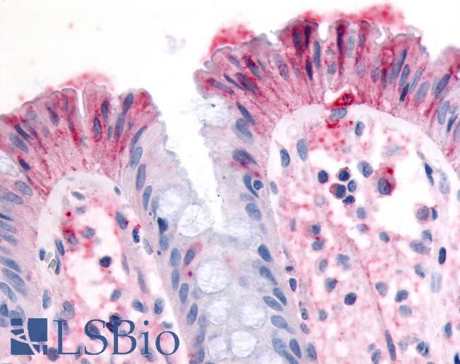 Anti-MST1R / RON antibody LS-A7191 IHC of human colon, surface epithelium. Immunohistochemistry of formalin-fixed, paraffin-embedded tissue after heat-induced antigen retrieval.