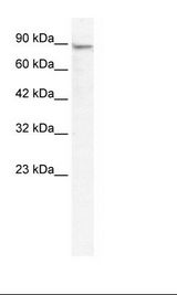 Jurkat Cell Lysate