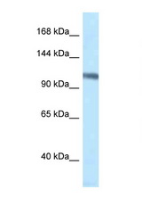 MCM4 antibody LS-C145320 Western blot of Rat Brain lysate. Antibody concentration 1 ug/ml.