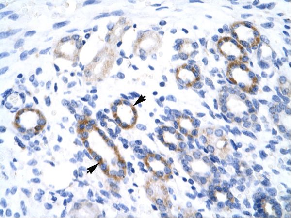YBX2 antibody LS-C30875 was used in IHC to stain formalin-fixed, paraffin-embedded human kidney.