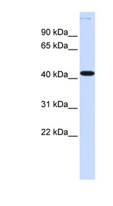 YBX2 antibody LS-C101499 Western blot of Fetal Lung lysate.