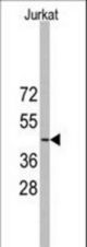 Western blot of anti-YBX2 Antibody (RB13983) in Jurkat cell line lysates (35 ug/lane). YBX2(arrow) was detected using the purified antibody.