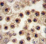Formalin-fixed and paraffin-embedded human testis tissue reacted with YBX2 antibody , which was peroxidase-conjugated to the secondary antibody, followed by DAB staining. This data demonstrates the use of this antibody for immunohistochemistry; clinical relevance has not been evaluated.