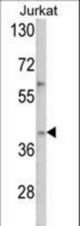 Western blot of YBX2 Antibody in Jurkat cell line lysates (35 ug/lane). YBX2 (arrow) was detected using the purified antibody.
