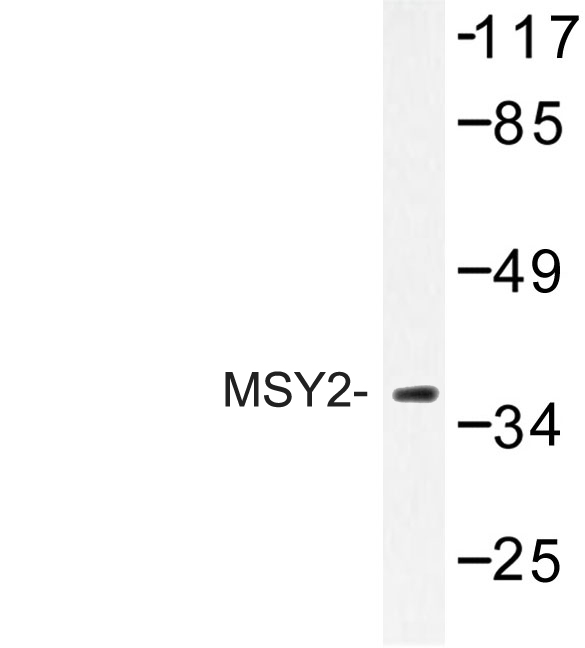 Western blot of MSY2 (G311) pAb in extracts from COLO205 cells.