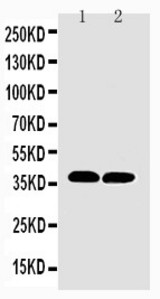 MTCO1 antibody Western blot. Lane 1: Rat Heart Tissue Lysate. Lane 2: Mouse Heart Tissue Lysate.