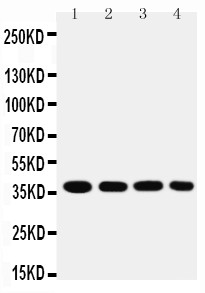 MTCO1 antibody Western blot. Lane 1: SMMC Cell Lysate. Lane 2: MCF-7 Cell Lysate. Lane 3: RAJI Cell Lysate. Lane 4: SW620 Cell Lysate.