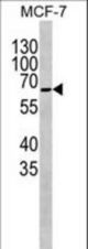 COXI Antibody western blot of MCF-7 cell line lysates.The COXI antibody detected the COXI protein (arrow)(Kindly provided by Dr. John Wu).