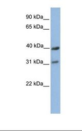721_B cell lysate. Antibody concentration: 1.0 ug/ml. Gel concentration: 12%.