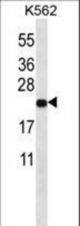 ND3 Antibody western blot of K562 cell line lysates (35 ug/lane). The ND3 antibody detected the ND3 protein (arrow).