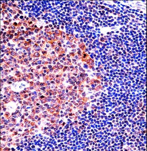 MCM4 Antibody immunohistochemistry of formalin-fixed and paraffin-embedded human tonsil tissue followed by peroxidase-conjugated secondary antibody and DAB staining.