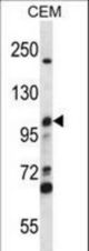 MCM4 Antibody western blot of CEM cell line lysates (35 ug/lane). The MCM4 antibody detected the MCM4 protein (arrow).