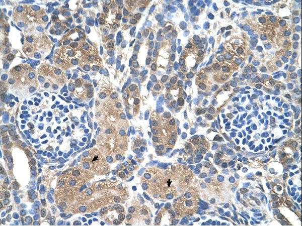 MTA2 antibody LS-C31938 was used in IHC to stain formalin-fixed, paraffin-embedded human kidney.