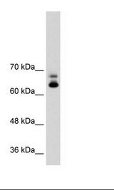 Jurkat Cell Lysate