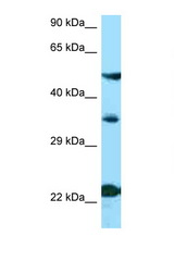 MC4R antibody LS-C146468 Western blot of ACHN Cell lysate. Antibody concentration 1 ug/ml.