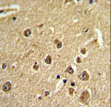 Formalin-fixed and paraffin-embedded human brain tissue reacted with PID/MTA2 Antibody , which was peroxidase-conjugated to the secondary antibody, followed by DAB staining. This data demonstrates the use of this antibody for immunohistochemistry; clinical relevance has not been evaluated.