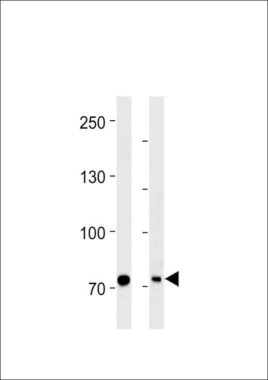 PID/MTA2 Antibody western blot of HeLa cell line and mouse brain tissue lysates (35 ug/lane). The PID/MTA2 antibody detected the PID/MTA2 protein (arrow).