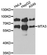 Western blot analysis of extracts of various cell lines, using MTA3 antibody.