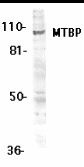 Western blot of MTBP expression in K562 whole cell lysates with MTBP antibody at 1 g /ml.