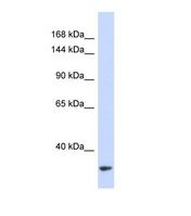 Western blot of Human 293T. MTBP antibody dilution 1.0 ug/ml.