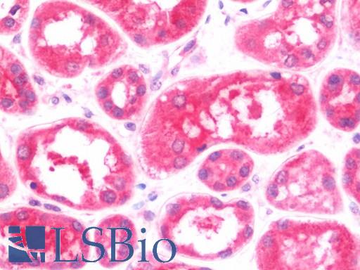Anti-MTBP antibody IHC staining of human kidney. Immunohistochemistry of formalin-fixed, paraffin-embedded tissue after heat-induced antigen retrieval. Antibody LS-B10863 concentration 7.5 ug/ml.