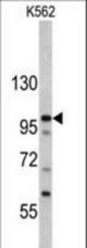 Western blot of MTBP antibody in K562 cell line lysates (35 ug/lane). MTBP (arrow) was detected using the purified antibody.