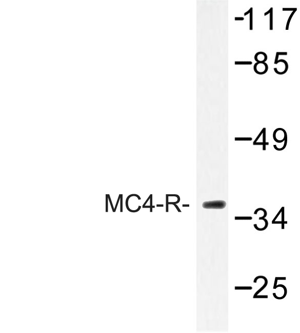 Western blot of MC4-R (E315) pAb in extracts from MCF-7 cells.