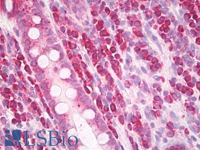 Anti-3D3 / MTDH antibody IHC of human colon. Immunohistochemistry of formalin-fixed, paraffin-embedded tissue after heat-induced antigen retrieval. Antibody LS-B8026 dilution 1:50.