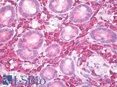 Anti-3D3 / MTDH antibody IHC of human colon. Immunohistochemistry of formalin-fixed, paraffin-embedded tissue after heat-induced antigen retrieval. Antibody LS-B8026 dilution 1:50.